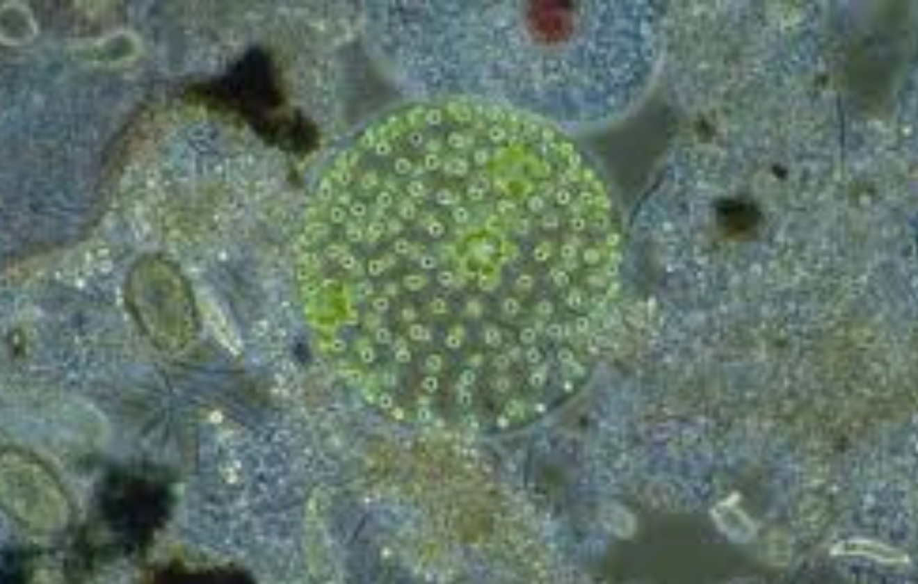 Azotobacter chroococcum