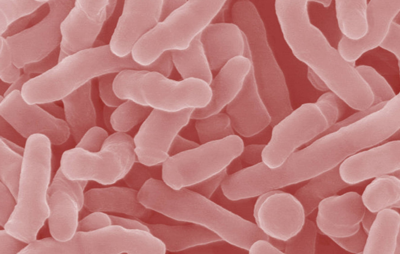 Bacillus azotofixans