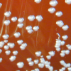 Burkholderia vietnamiensis