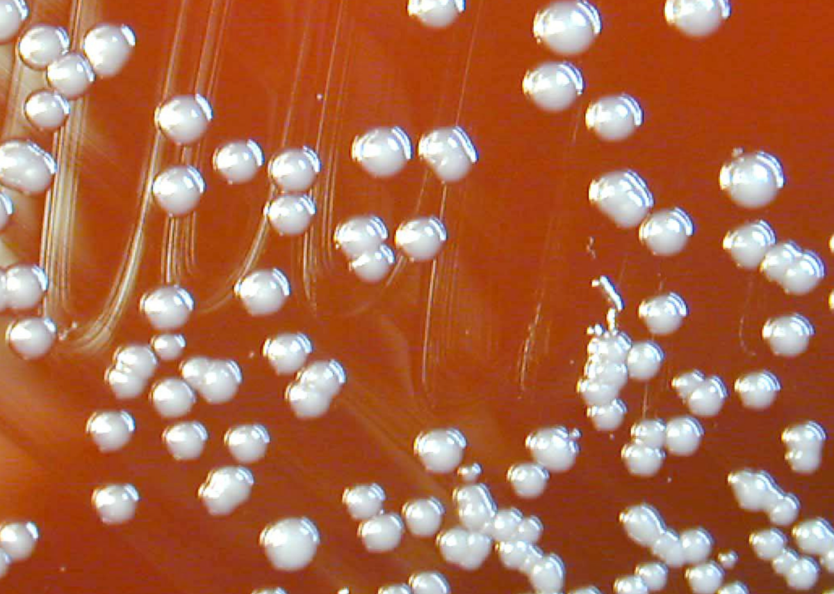 Burkholderia vietnamiensis