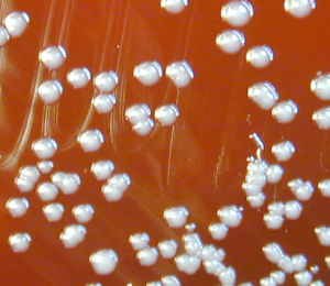 Burkholderia vietnamiensis