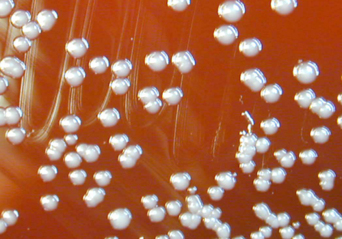 Burkholderia vietnamiensis