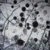 Gluconacetobacter diazotrophicus