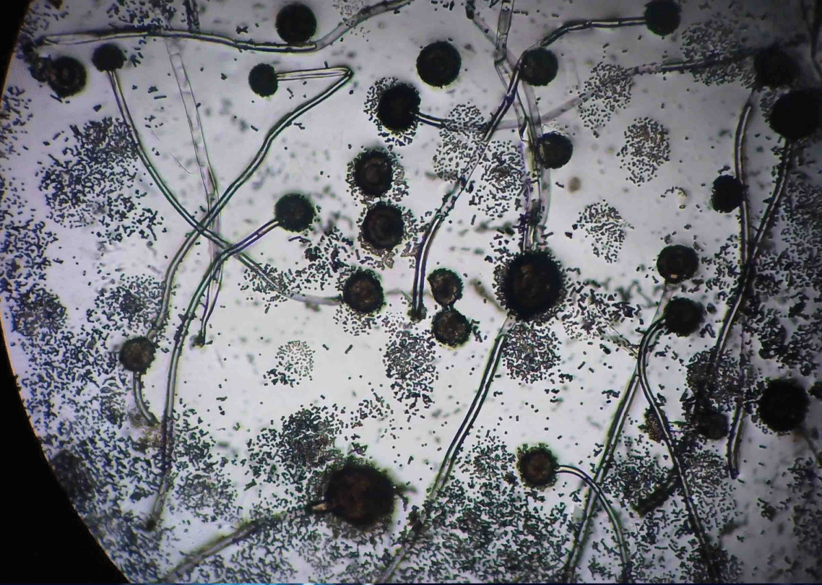Gluconacetobacter diazotrophicus