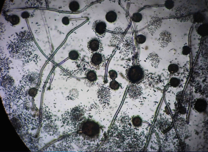 Gluconacetobacter diazotrophicus