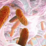 Klebsella pneumoniae