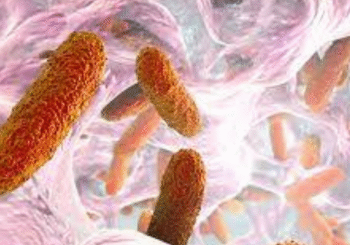 Klebsella pneumoniae