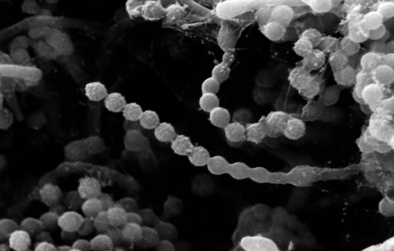 Paecilomyces lilacinus