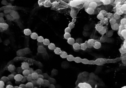 Paecilomyces lilacinus
