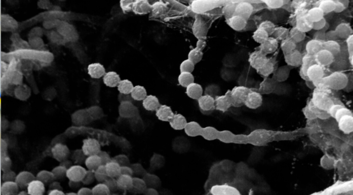 Paecilomyces lilacinus