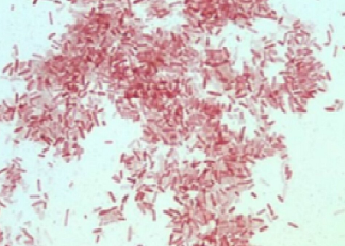 Photorhabdus luminescens