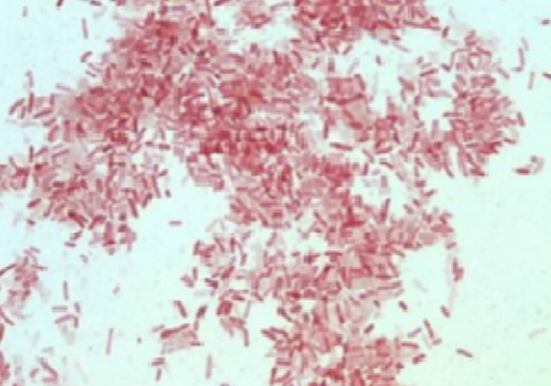 Photorhabdus luminescens