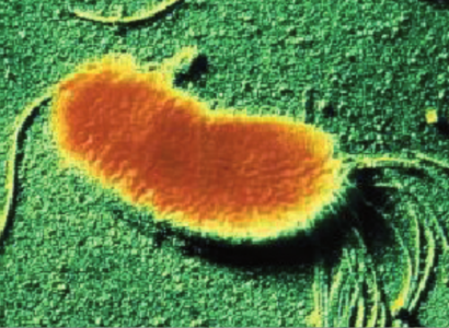 Pseudomonas fluorescens