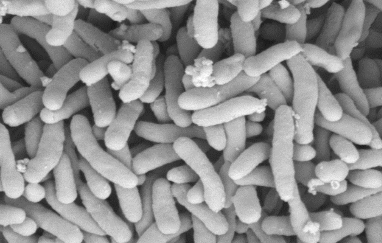 Pseudomonas stutzeri