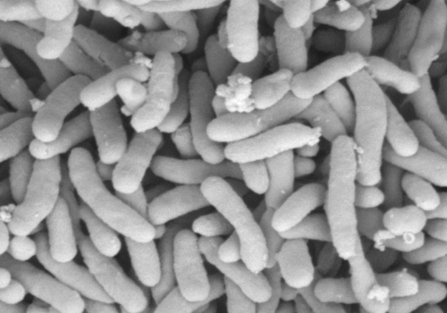 Pseudomonas stutzeri