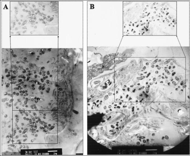 TEM image showing detailed root nodule development.