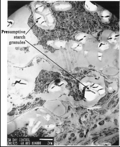 TEM image of the internal structure of nodule cells.