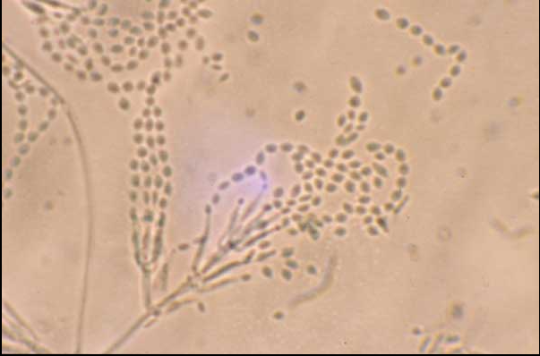 Microscopic View of Paecilomyces lilacinus
