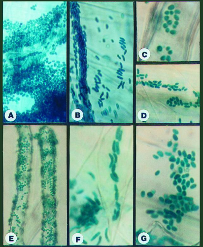Microscopic View of Fungal Colonization on Roots