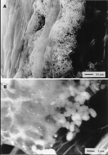 Scanning Electron Microscopy of Fungi on Root Surfaces