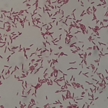 Serratia fonticola