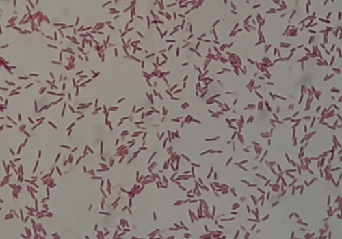 Serratia fonticola
