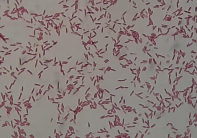 Serratia fonticola