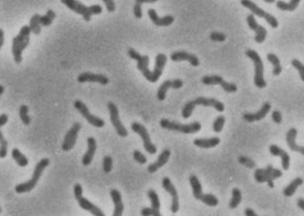 Xanthobacter autotrophicus