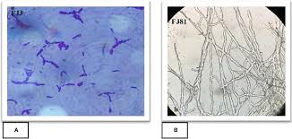 Microscopic images showing what Bacillus FJ3 (A) and Fusarium FJ81 (B) look like up close.