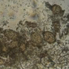 Ampelomyces quisqualis