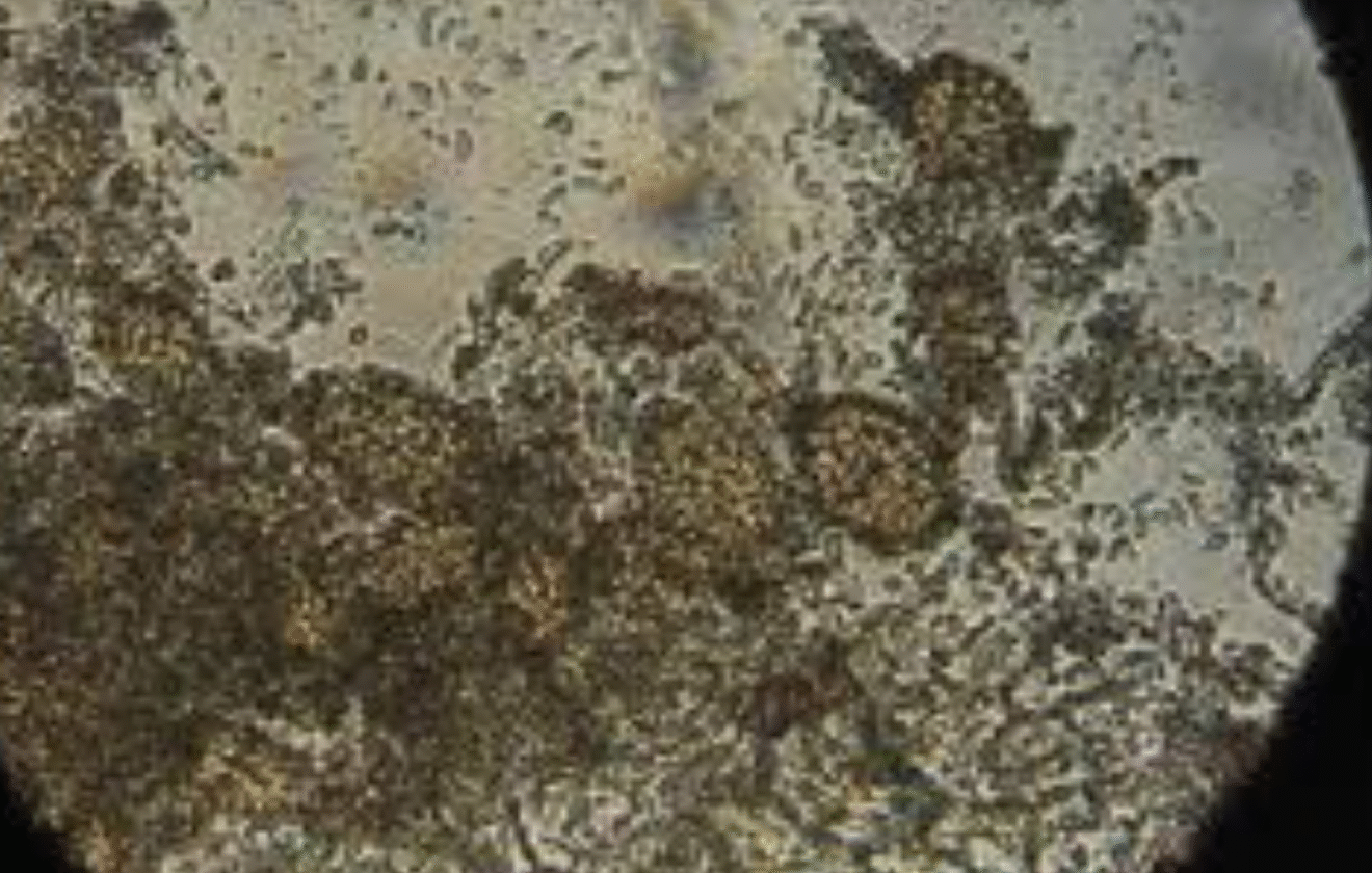 Ampelomyces quisqualis