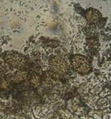 Ampelomyces quisqualis