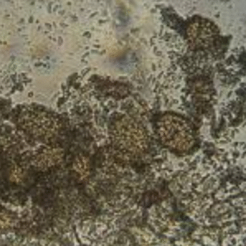 Ampelomyces quisqualis