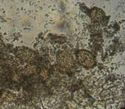 Ampelomyces quisqualis