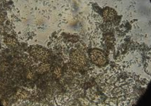 Ampelomyces quisqualis
