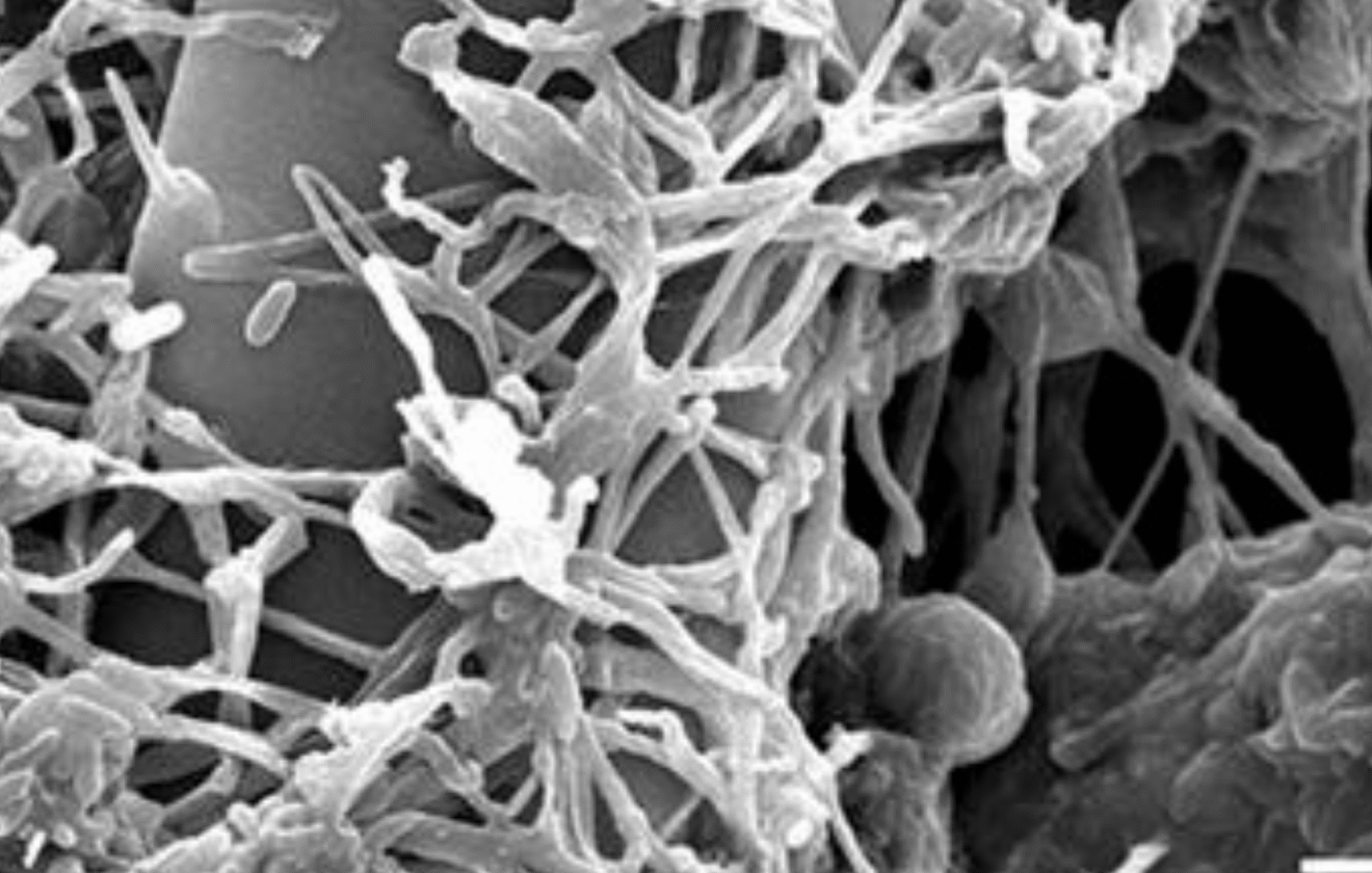 Lecanicillium longisporum