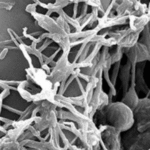 Lecanicillium longisporum