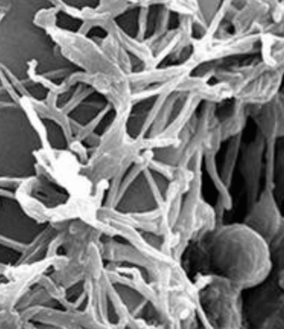 Lecanicillium longisporum