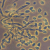 Metarhizium anisopliae
