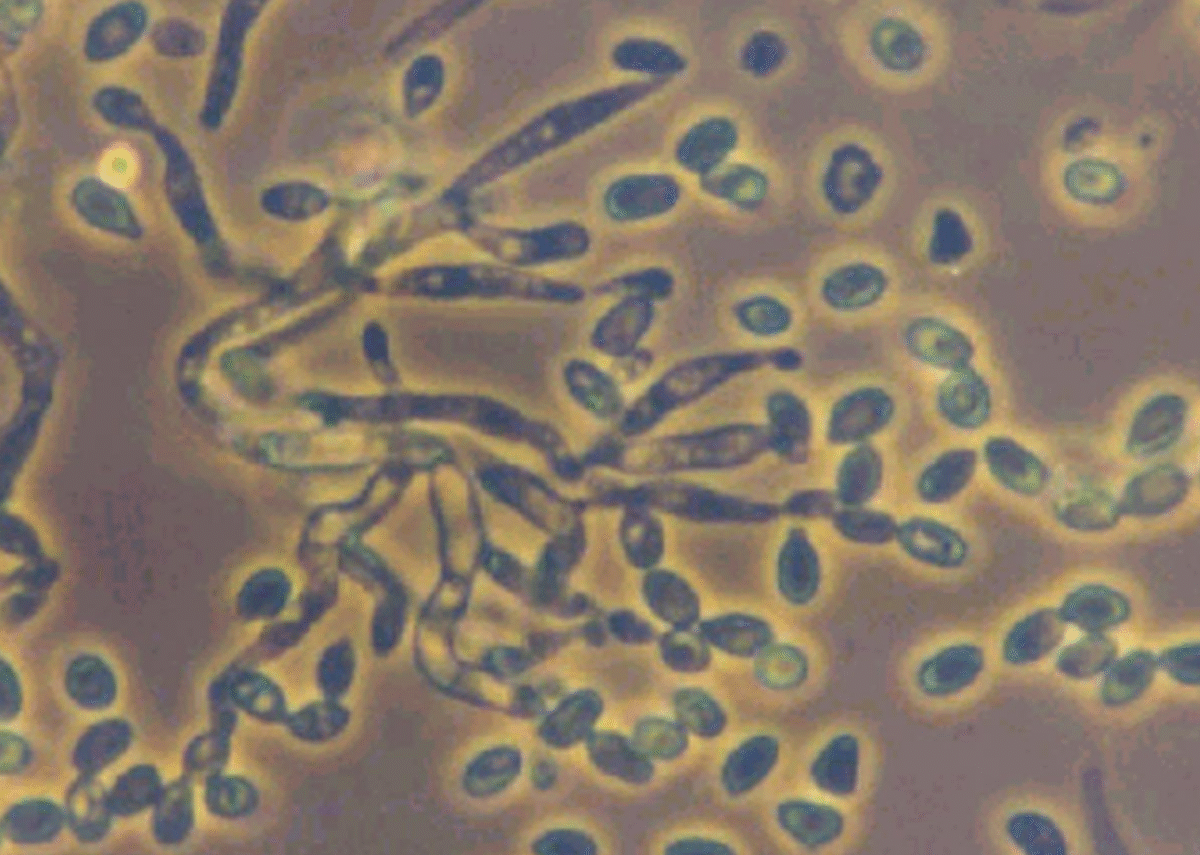 Metarhizium anisopliae