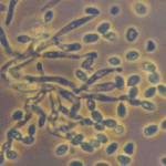 Metarhizium anisopliae
