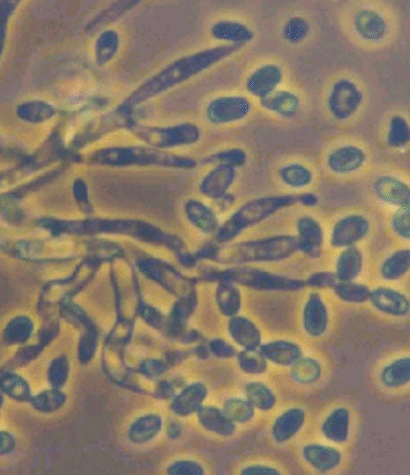 Metarhizium anisopliae