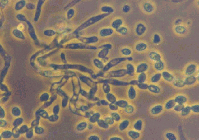 Metarhizium anisopliae